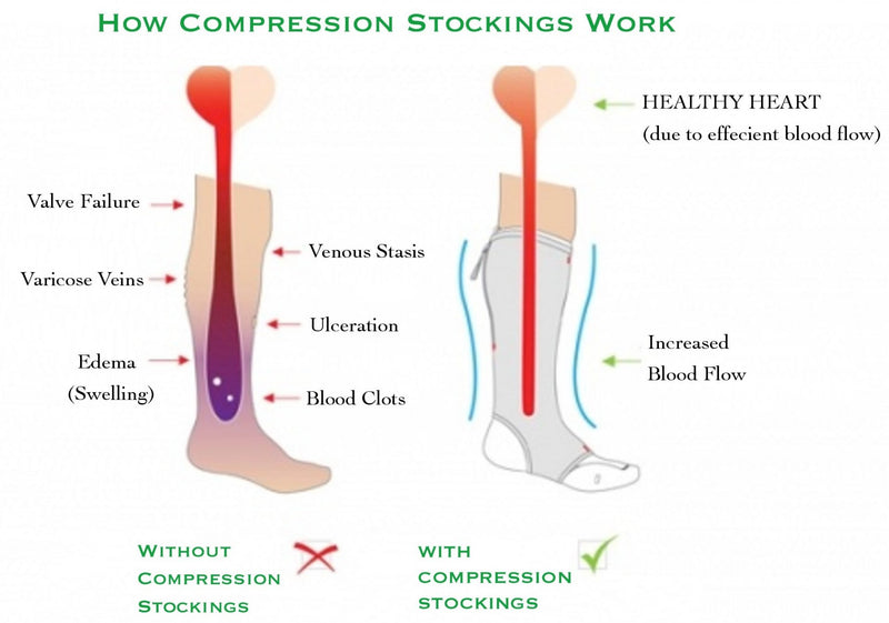 Compression Socks-50% OFF TODAY ONLY